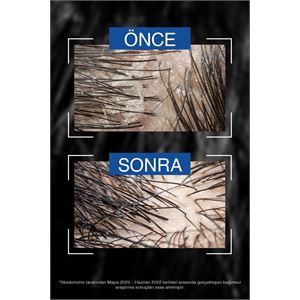 BİOBLAS MENTOL-KOMPLE MEN KEPEĞE KARŞI ŞAMPUAN 360ML-