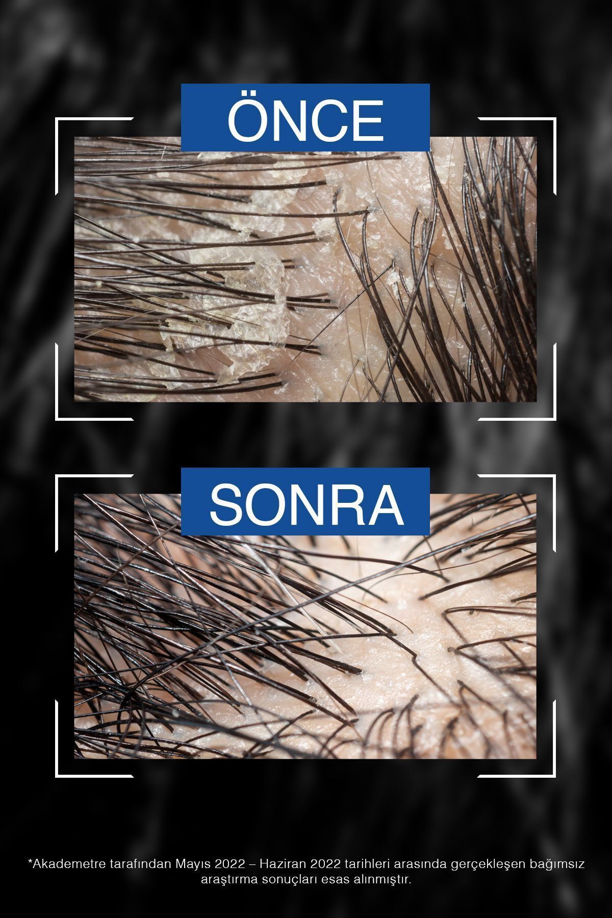 BİOBLAS MENTOL-KOMPLE MEN KEPEĞE KARŞI ŞAMPUAN 360ML-