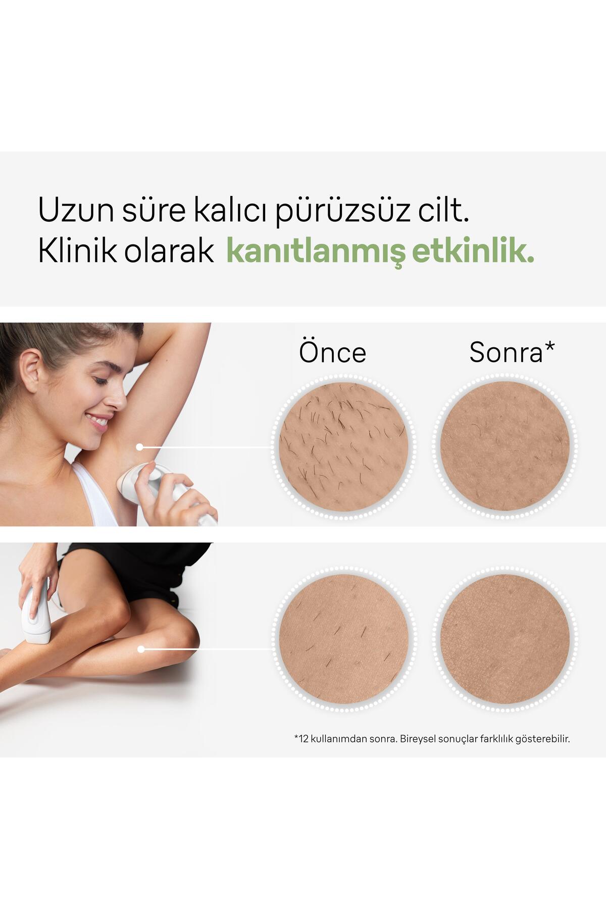 Braun IPL Silk·expert Pro 3, Evde Tüy Alma, Çanta, Venus Tıraş Makinesi, 2 Başlık ile, PL3132-