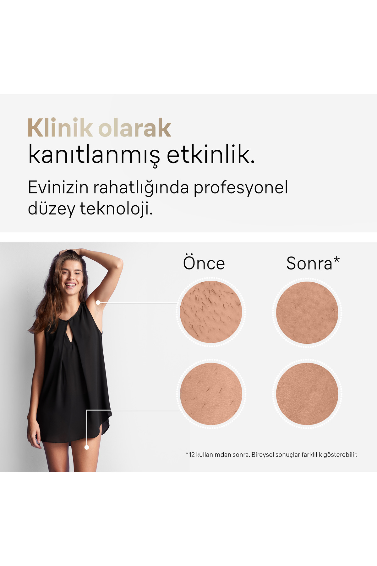 Braun Silk Expert Pro 5 PL5159 Epilasyon Aleti-