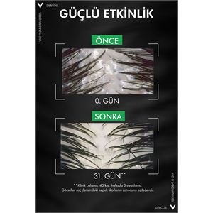 Vichy Dercos Anti-Dandruff Kepek Karşıtı Şampuan 3-