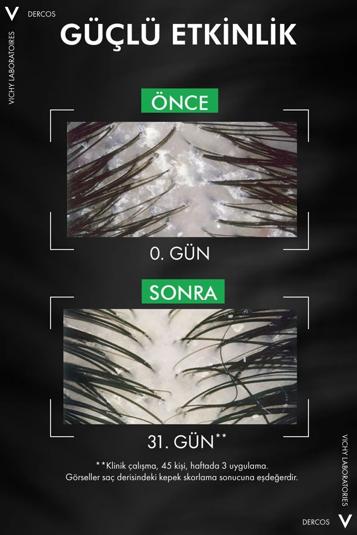 Vichy Dercos Anti-Dandruff Kepek Karşıtı Şampuan 3-