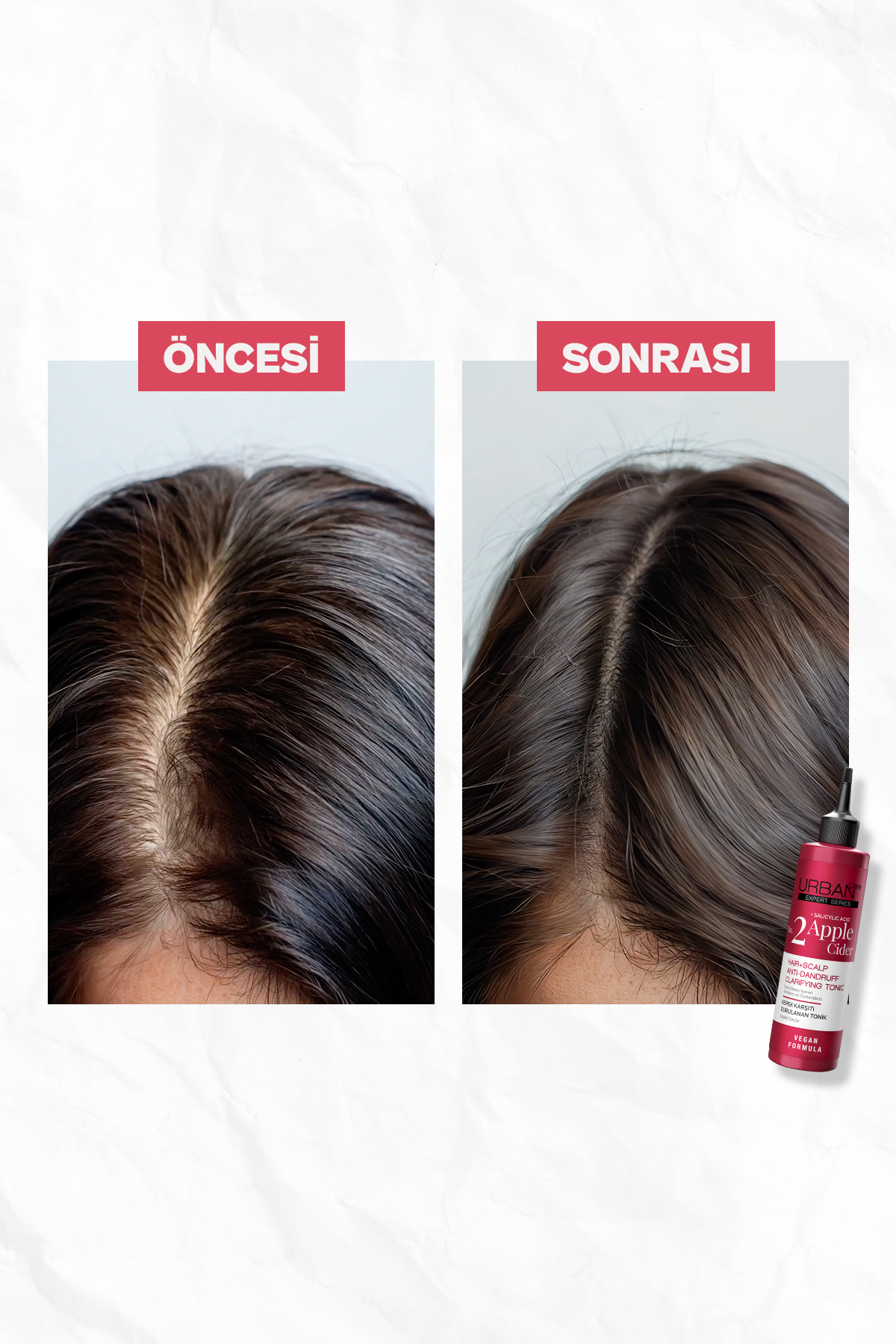 Urban Care No.2 Expert Apple Cider Kepek Karşıtı T-