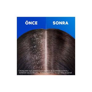 Head And Shoulders Şampuan Kadınlara Özel Saç Dökü-