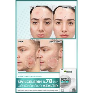 Garnier Pimple Patch 22'li Sivilce Bandı / Hidrokolloid Bant / Akne Karşıtı 22li Bant-