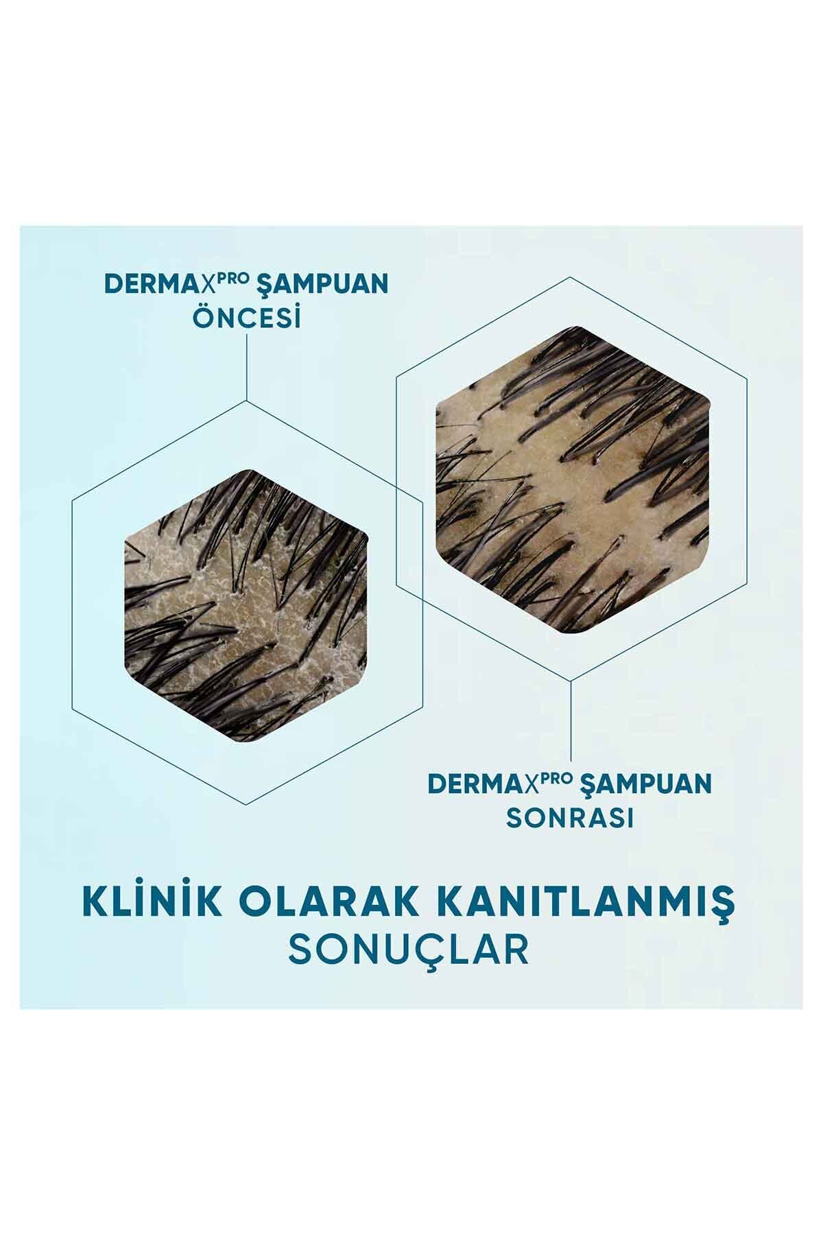 Head And Shoulders Dermaxpro Scalp & Hair Revitaliser Dökülme Ve Kepek Karşıtı Şampuan Kafein Ve Seramid-