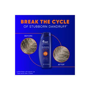 Head And Shoulders Head & Shoulders Clinical Strength Şampuan 400 ml-