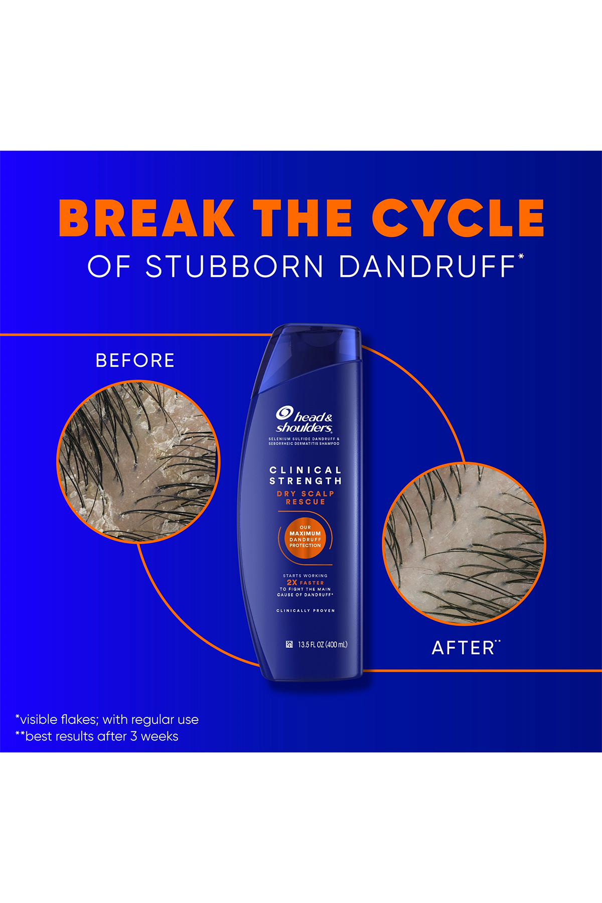 Head And Shoulders Head & Shoulders Clinical Strength Şampuan 400 ml-