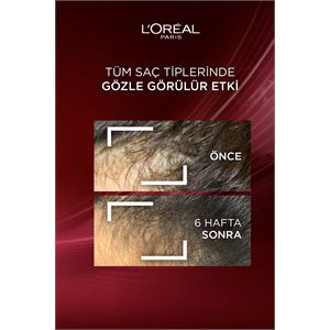 Elseve Şampuan Dökülme 300ml-