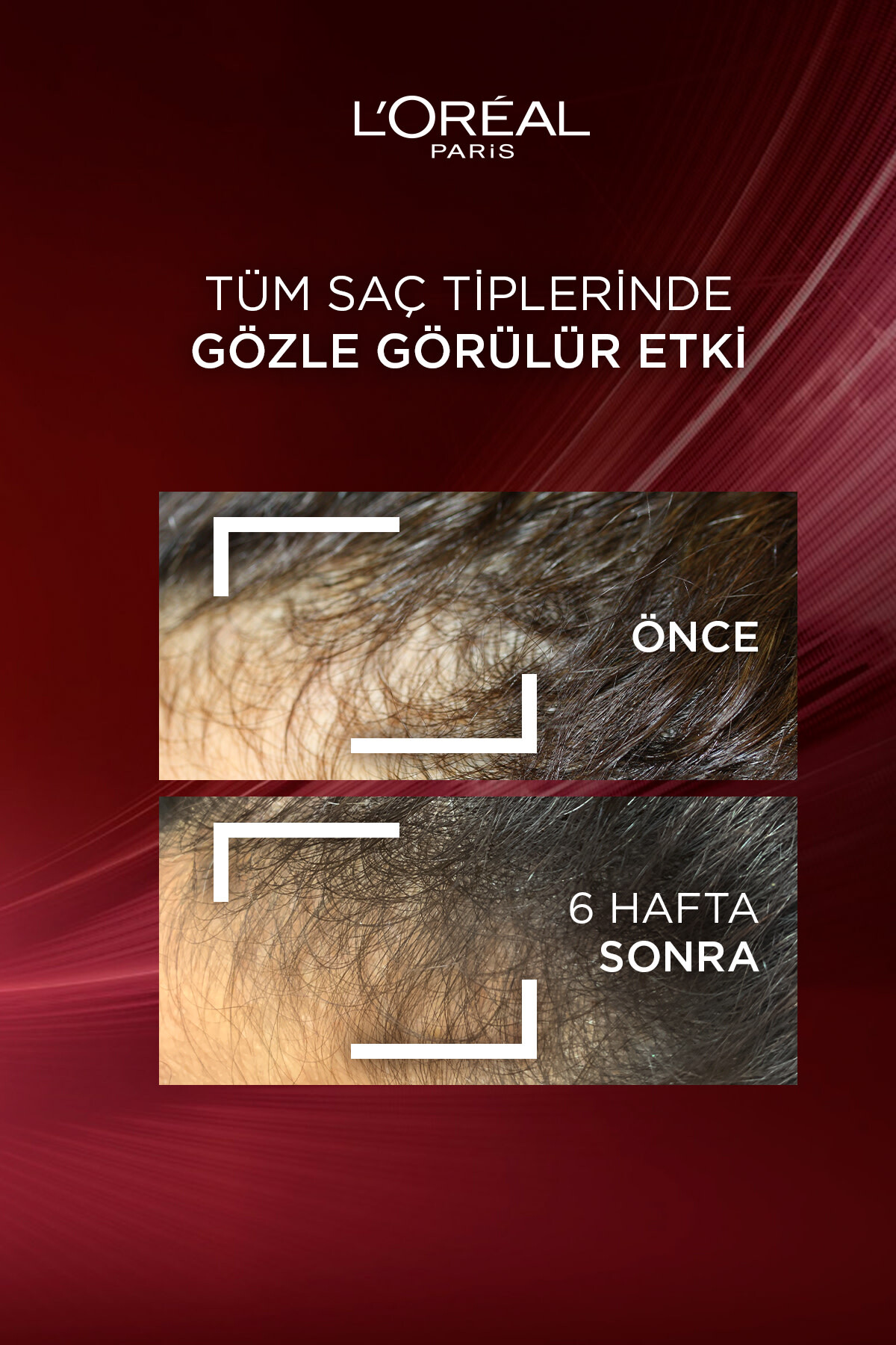 ELSEVE KOMPLE DİRENÇ DÖKÜLME KARSITI SAÇ BAKIM KREMİ-