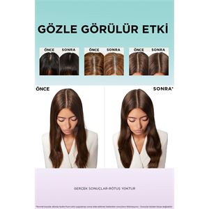 ELSEVE HYALURONIC PURE YAGLANMA KARSITI ŞAMPUAN-