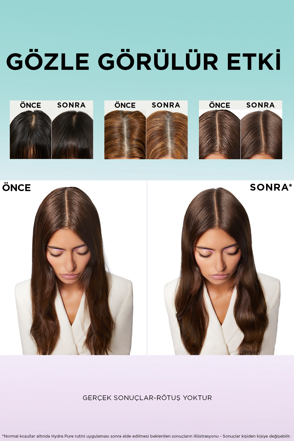 ELSEVE HYALURONIC PURE YAGLANMA KARSITI ŞAMPUAN-